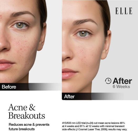 Elle Led Mask Radiance Boost Pro Facewear Pink Colour