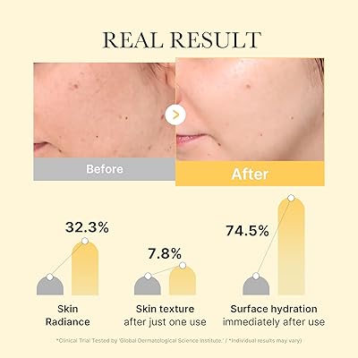 Medicube Kojic Acid Turmeric Brightening Gel Mask 4Pcs